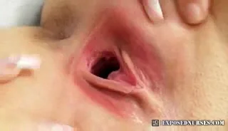 Nasty Looking Vagina